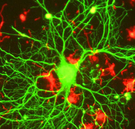 neuron_in_tissue_culture