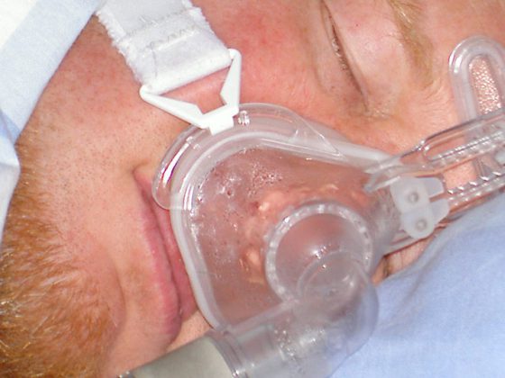 schlafapnoe_cpap_schnarchen