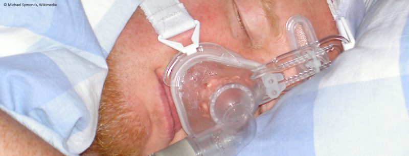 schlafapnoe_cpap_schnarchen