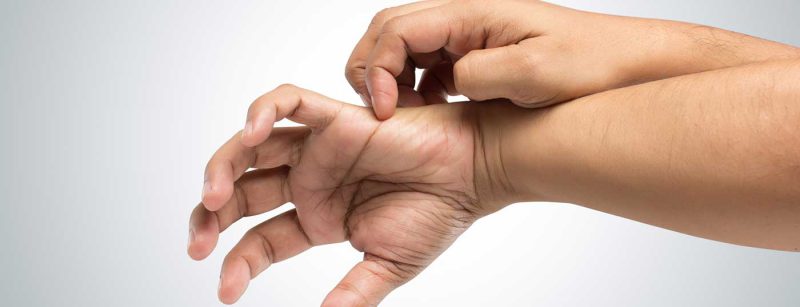 hand_kratzen_jucken