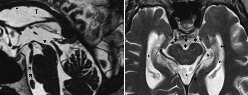 header_neuroimagesnp4