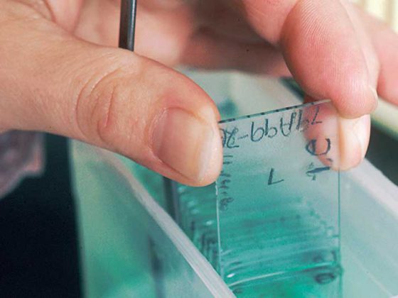 monoclonal_antibodies