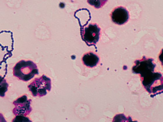 streptococcus_viridans