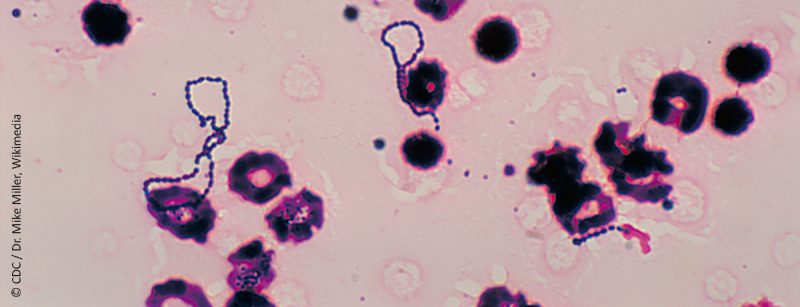 streptococcus_viridans