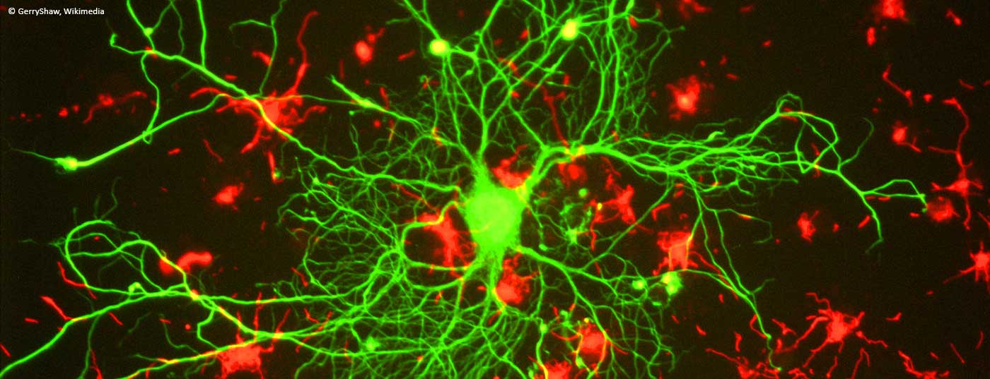 neuron_in_tissue_culture