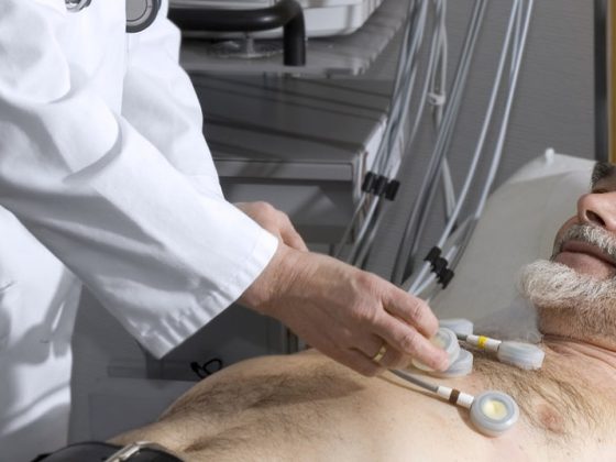 ekg_herz
