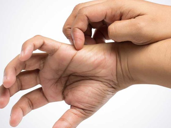 hand_kratzen_jucken