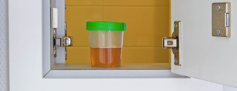 urin_harn_blase_urinprobe