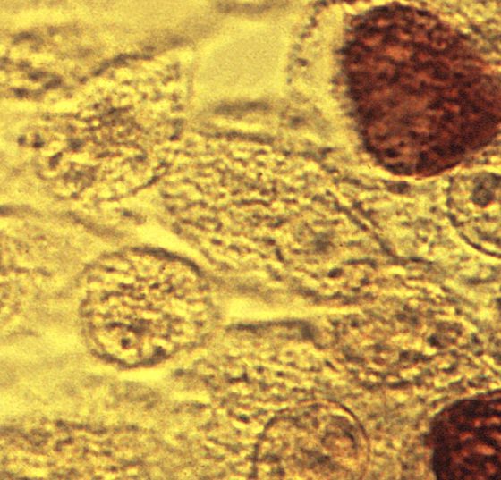 chlamydia_trachomatis