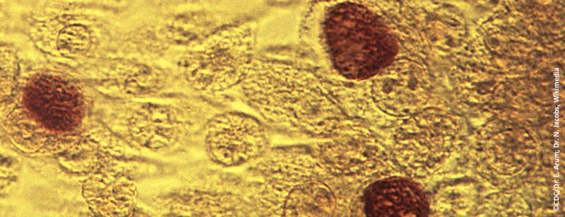 chlamydia_trachomatis