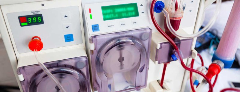 dialyse_blutwasche_niere