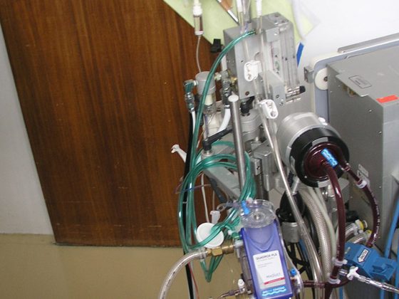 ecmo_in_h1n1_patient_in_santa_cruz_hospital_-_lisbon