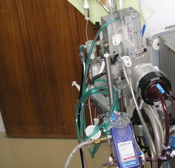 ecmo_in_h1n1_patient_in_santa_cruz_hospital_-_lisbon