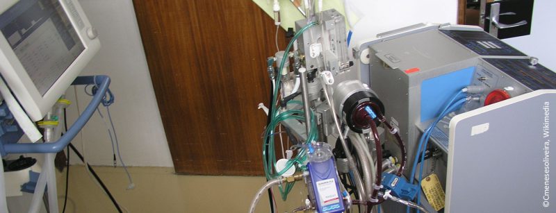 ecmo_in_h1n1_patient_in_santa_cruz_hospital_-_lisbon