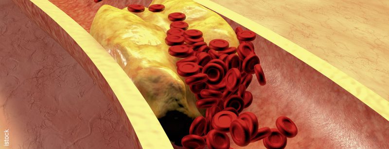 blut3