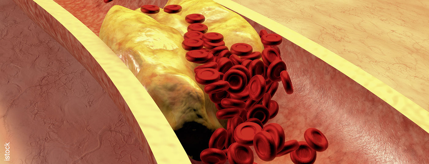blut3