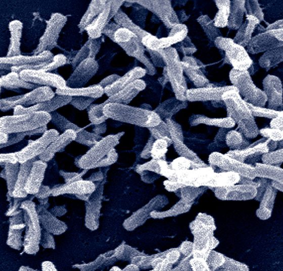 clostridium_difficile