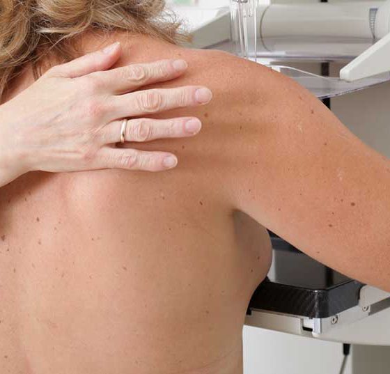 mammografie_brustkrebs