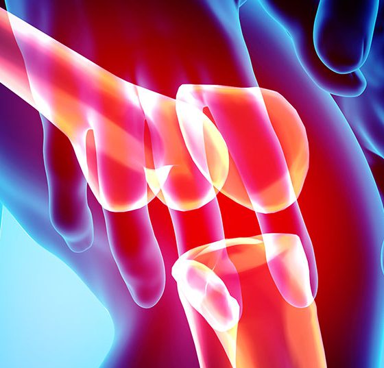 arthrose_knie_istock-956015414