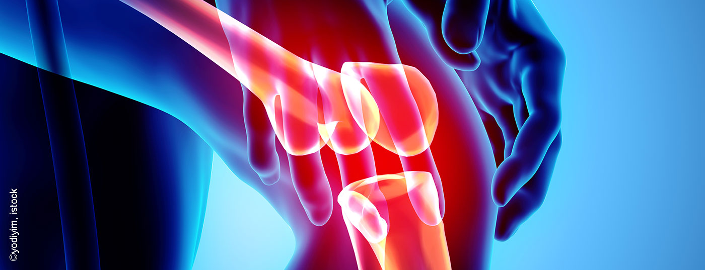 arthrose_knie_istock-956015414
