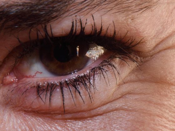 auge_frau_istock-658371830