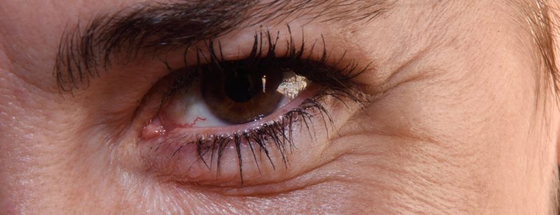 auge_frau_istock-658371830