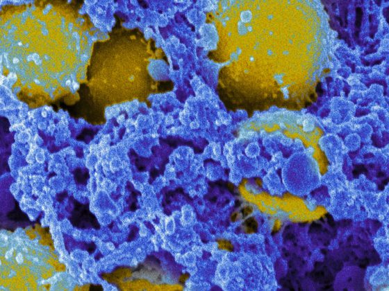 staphylococcus_aureus_bacteria_7739552618