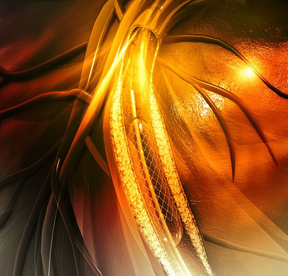 stent_istock-475746604