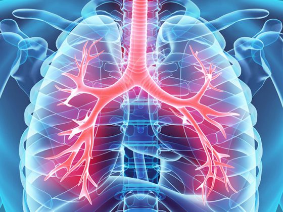 kehle_hals-lunge_fotolia_109032065_m