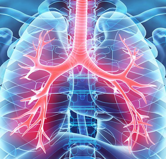 kehle_hals-lunge_fotolia_109032065_m