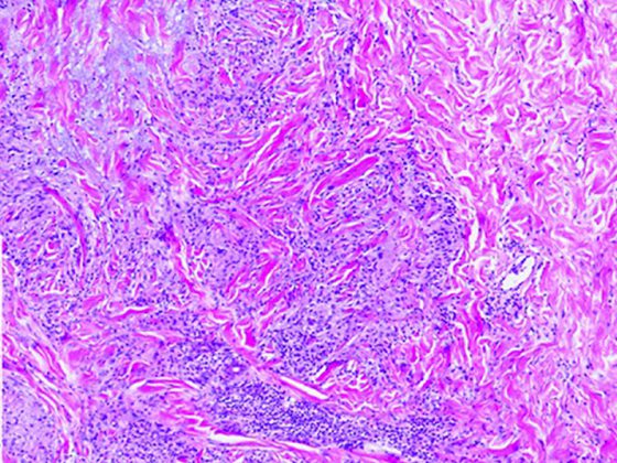 ddg12610_suppl-fig-0001-m