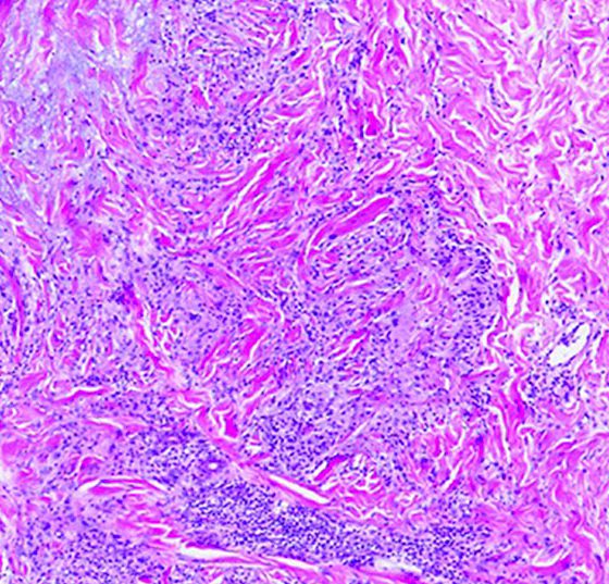 ddg12610_suppl-fig-0001-m