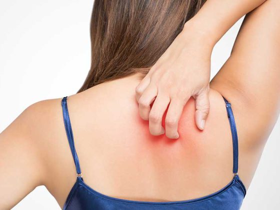 haut_ekzem_istock-667274656