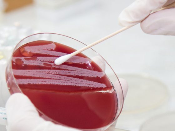 bakterienkultur_istock-485376993