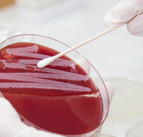 bakterienkultur_istock-485376993