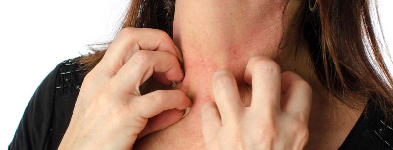 haut_juckreiz_dermatitis