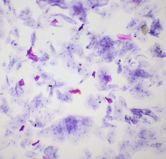 mundschleimhaut_istock-924322314