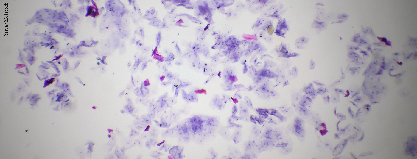 mundschleimhaut_istock-924322314