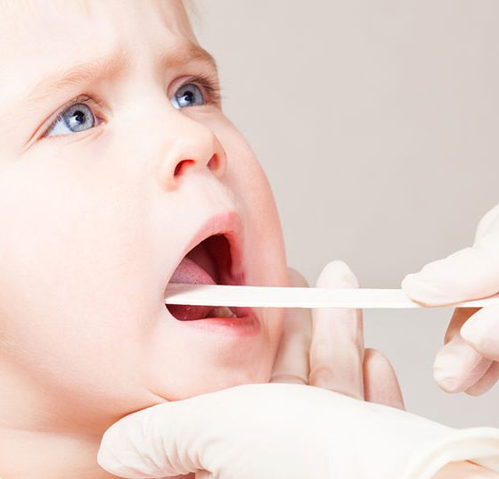 angina_kind_halsweh_istock-629568594