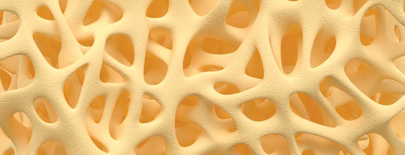 knochen_osteoporose