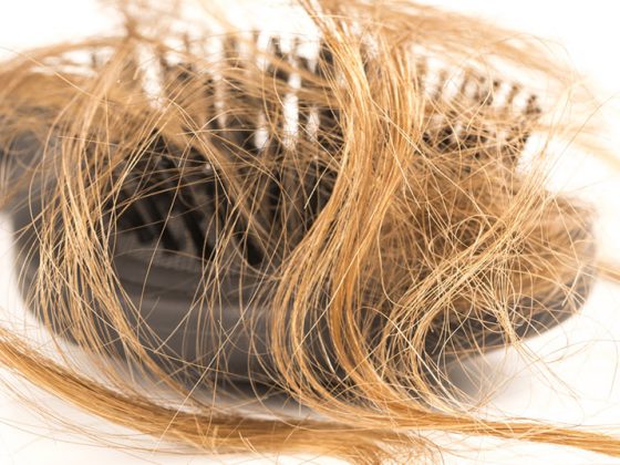 haarausfall_116489512_m