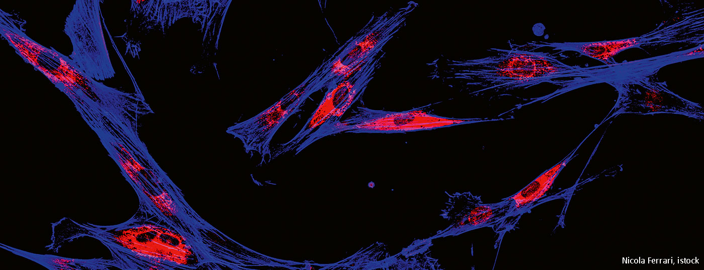 melanomzellen_istock-697088710