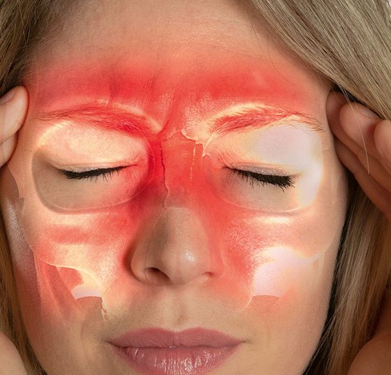 nebenhoehlen_istock-1130110789