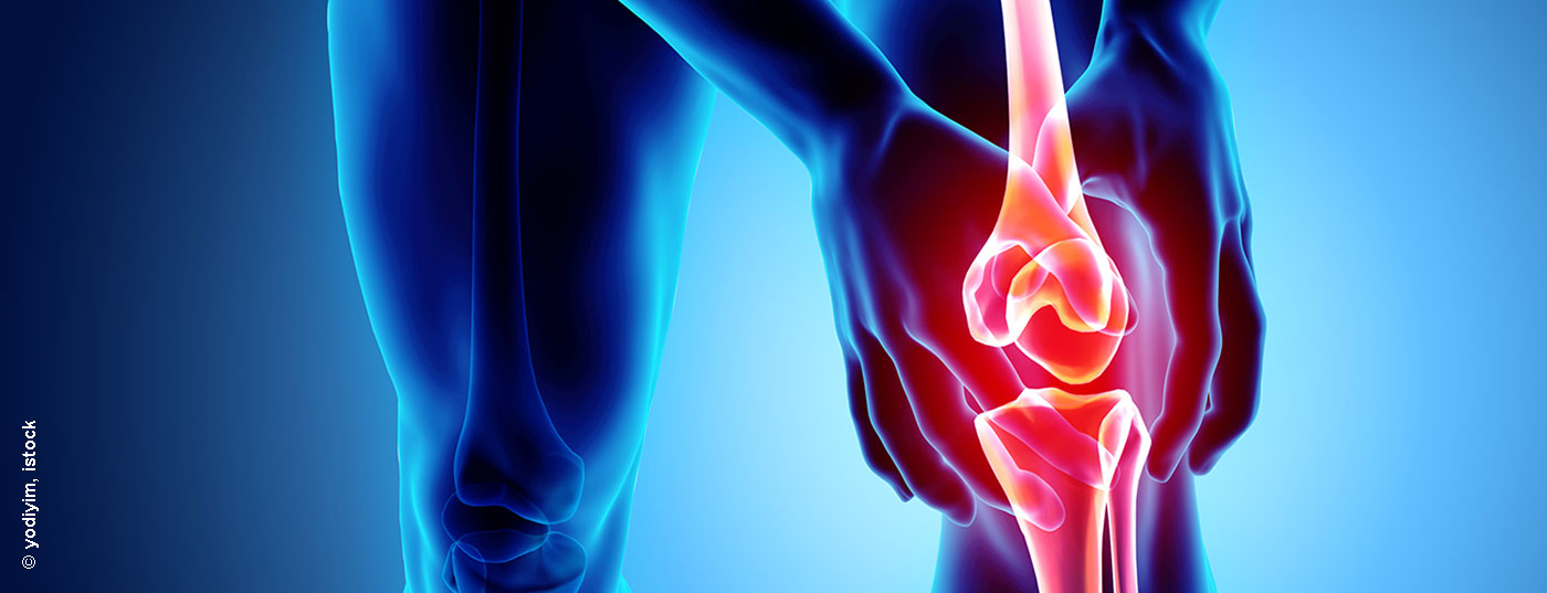 arthrose-knie_istock-956015576