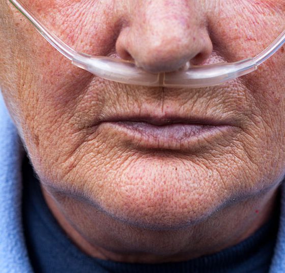 copd_istock-522695539