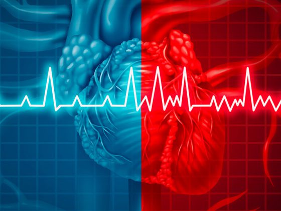 ekg_vorhofflimmern_istock-947331372