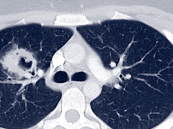 header_kleymann_abb_1