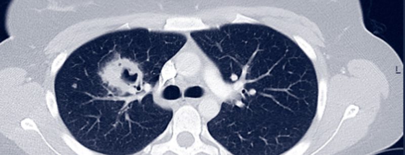 header_kleymann_abb_1