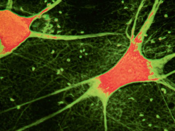 neuronen_istock-1165714317