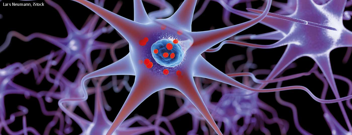 parkinson_958919028